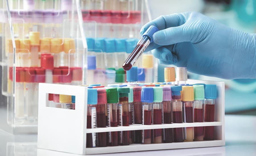 Importance of pre-analytics for metabolomics studies
